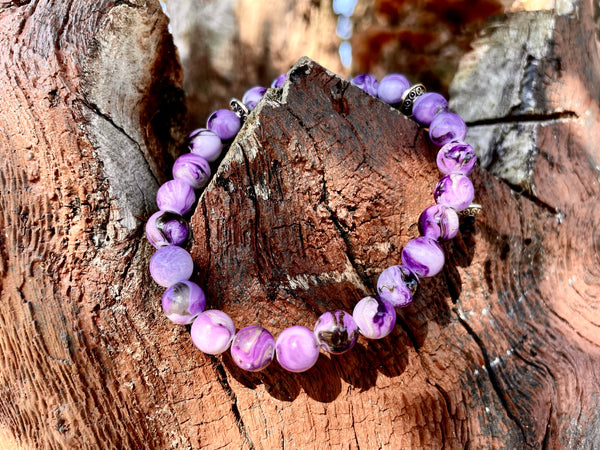 Trippy bracelets
